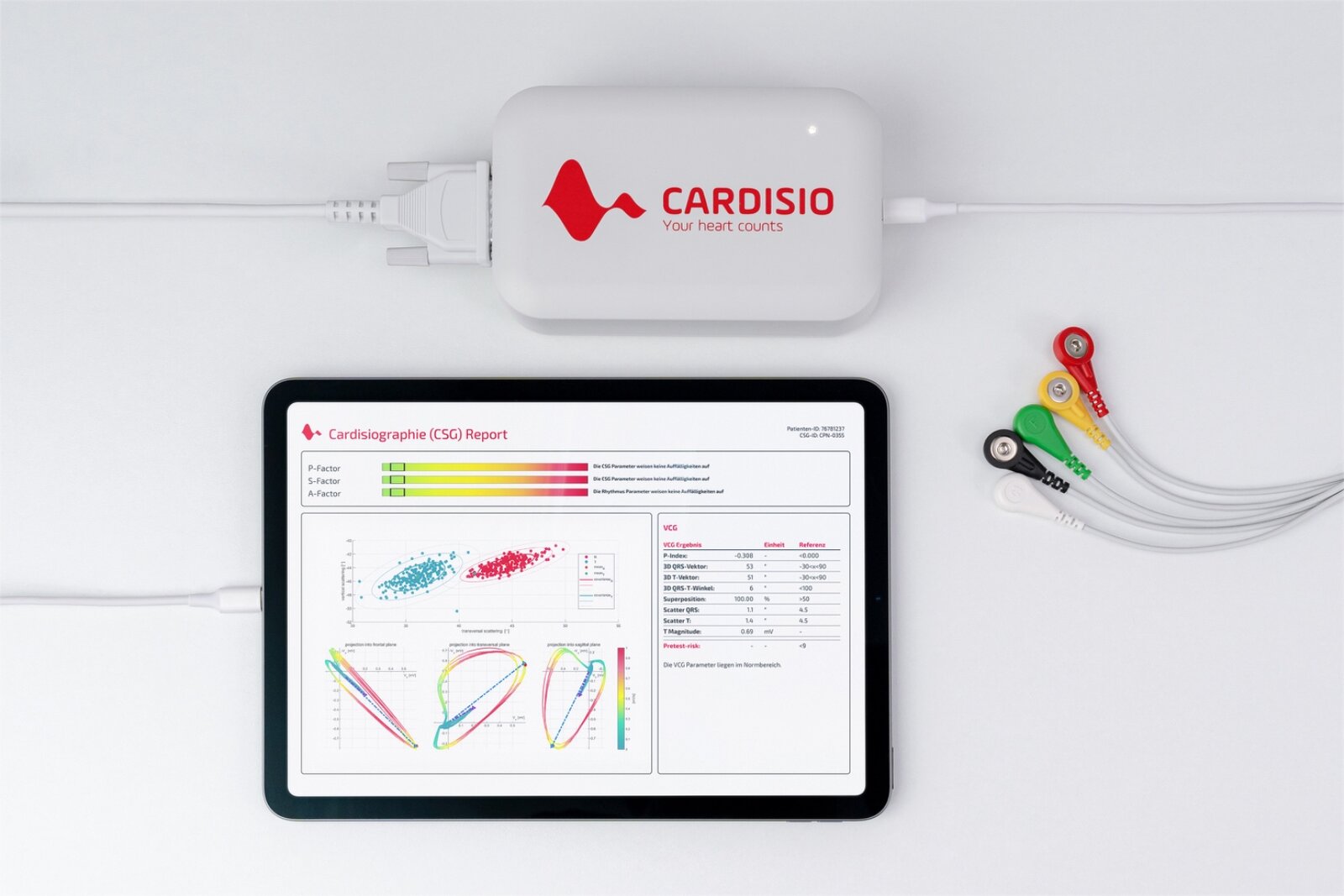 Cardisio device alongside a tablet showing a CSG report